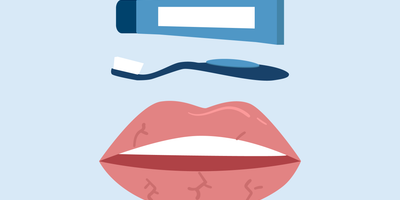 can toothpaste cause dry lips