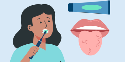 can toothpaste cause dry mouth