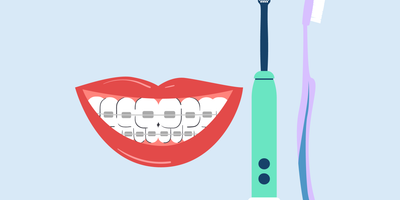 can you use an electric toothbrush with braces 