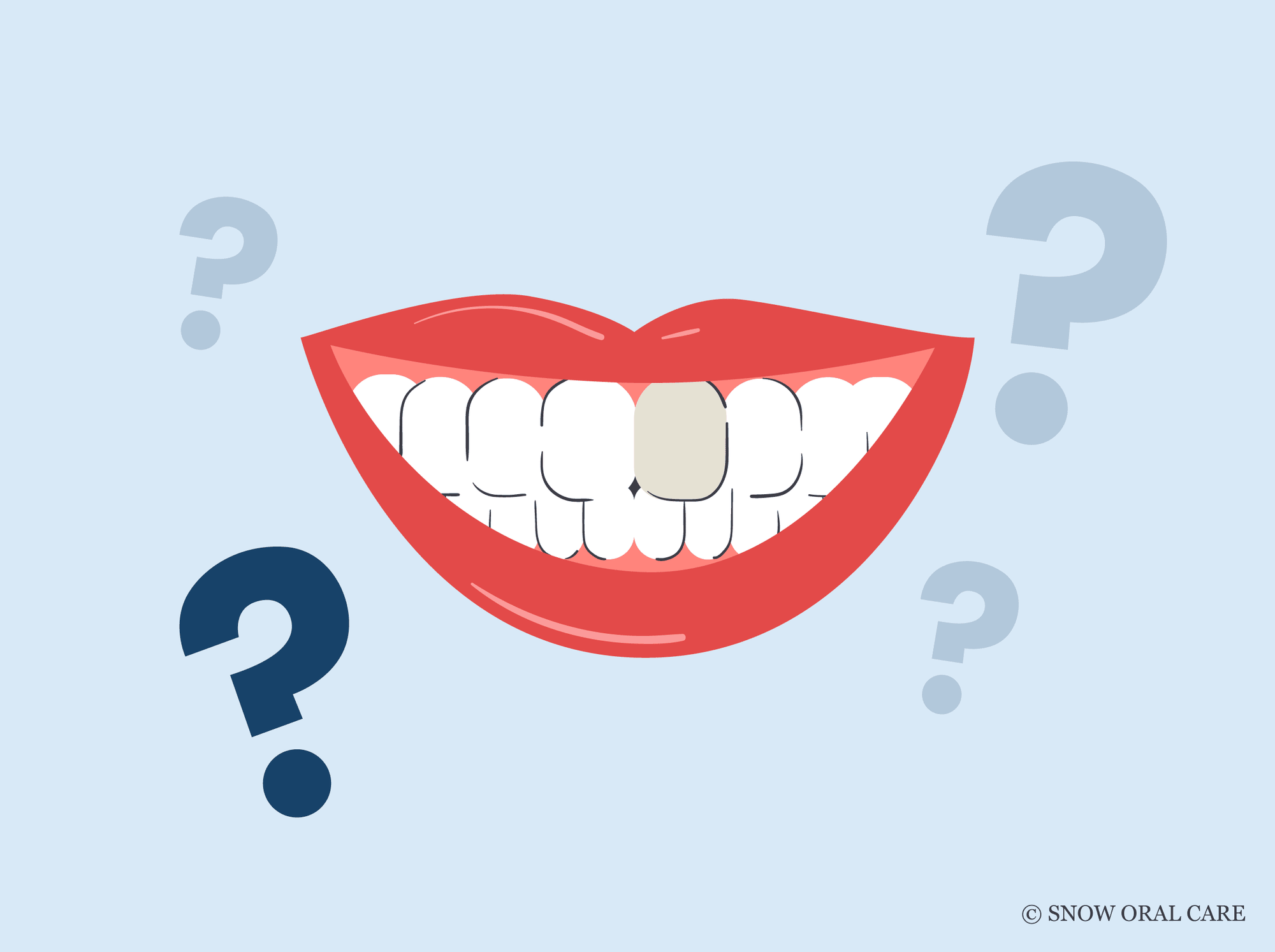 can you whiten a dead tooth 