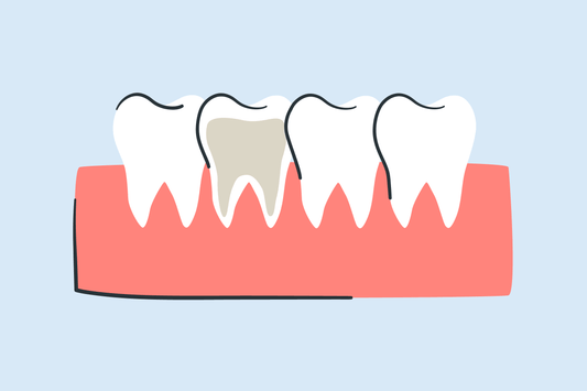 can you whiten a root canal tooth 