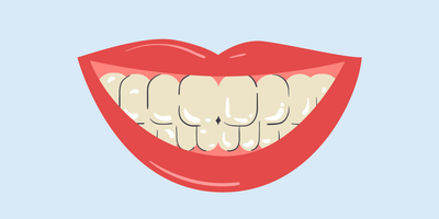 dehydrated teeth white spots