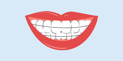 do retainers make your teeth yellow 