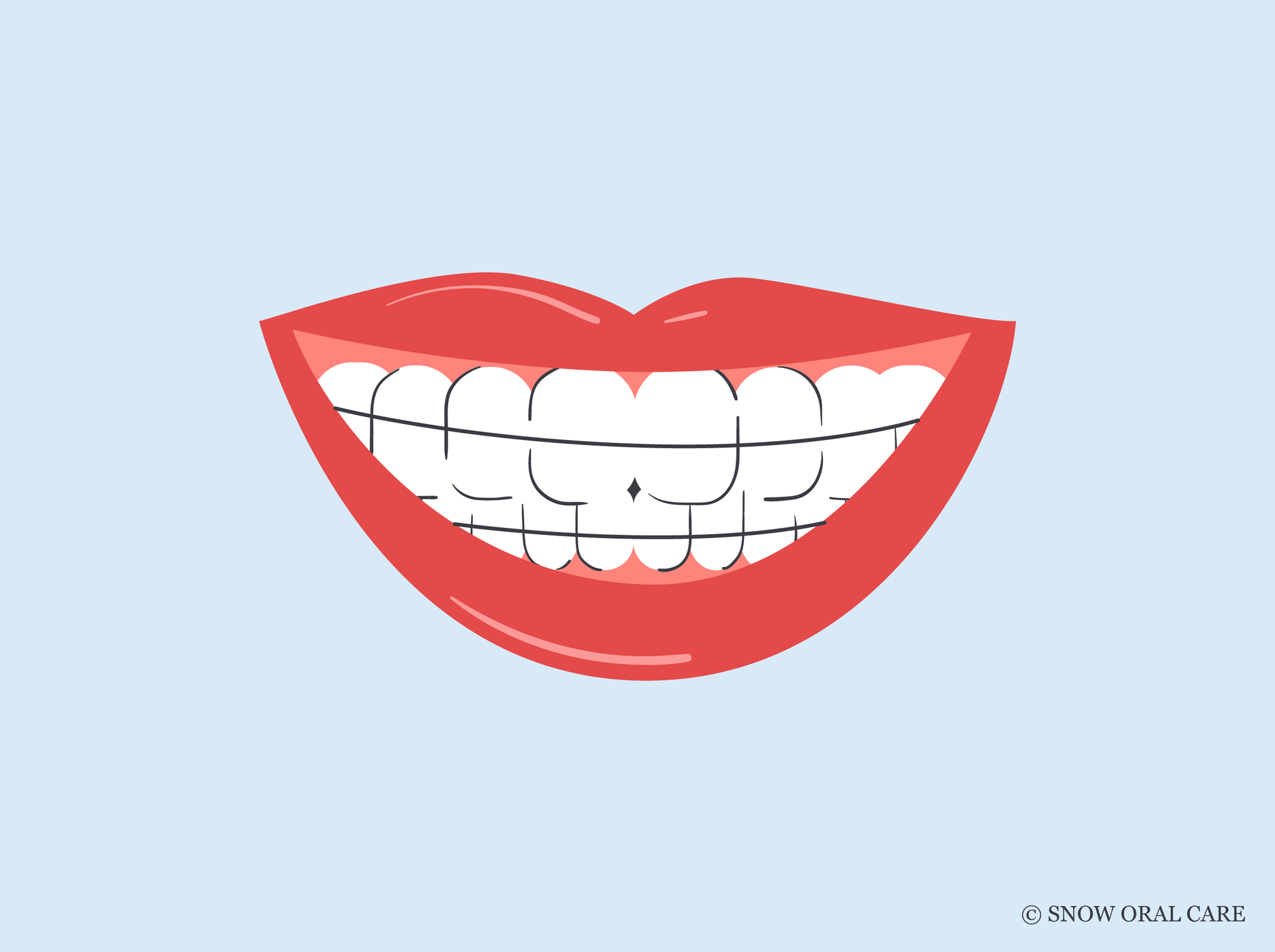 do retainers make your teeth yellow 