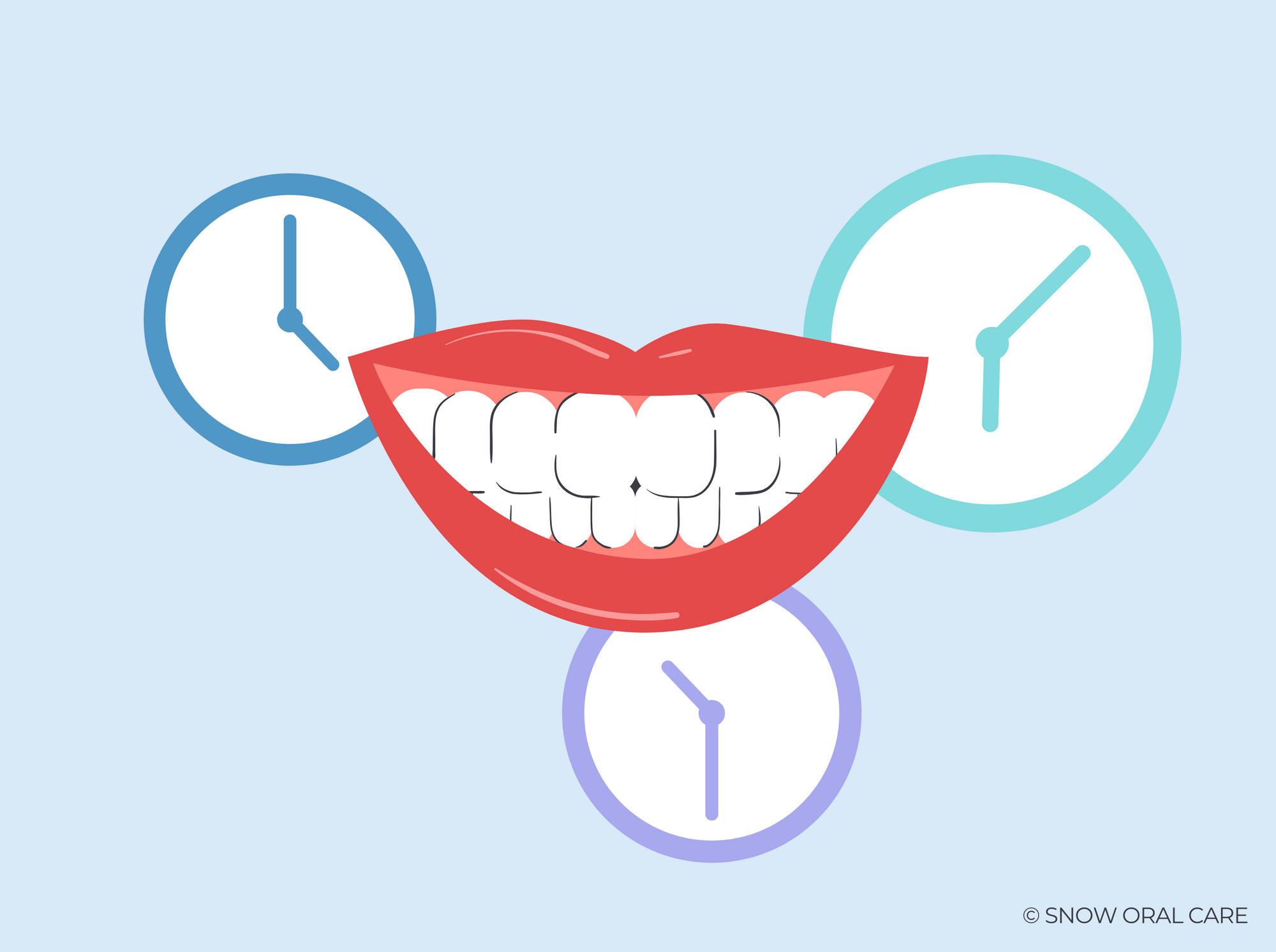 do teeth continue to whiten after treatment