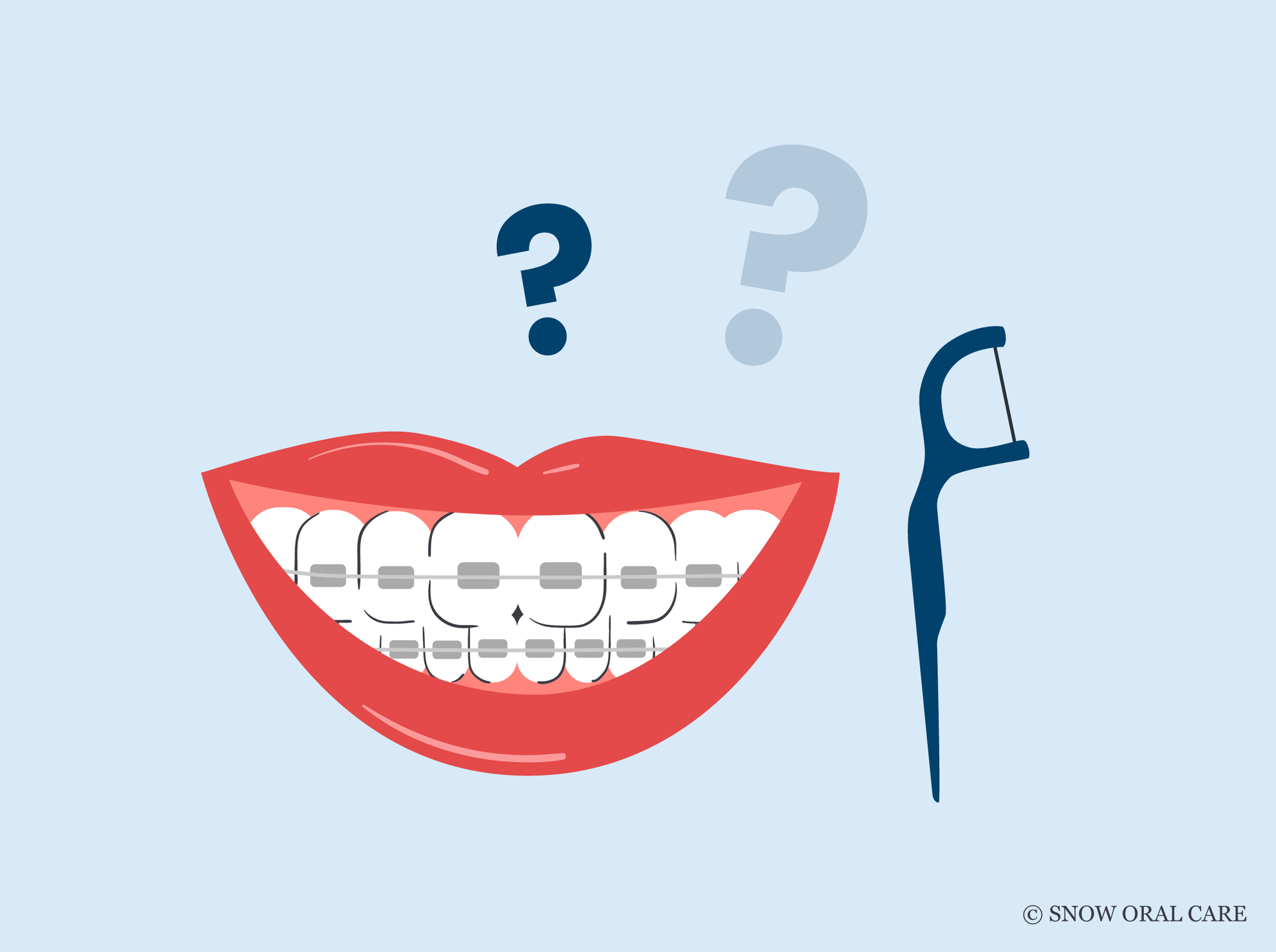 do you have to floss with braces