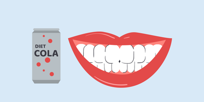 does diet soda stain teeth 