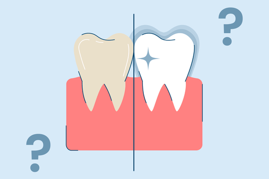 Does Fluoride Whiten Teeth? Here's Everything You Need to Know