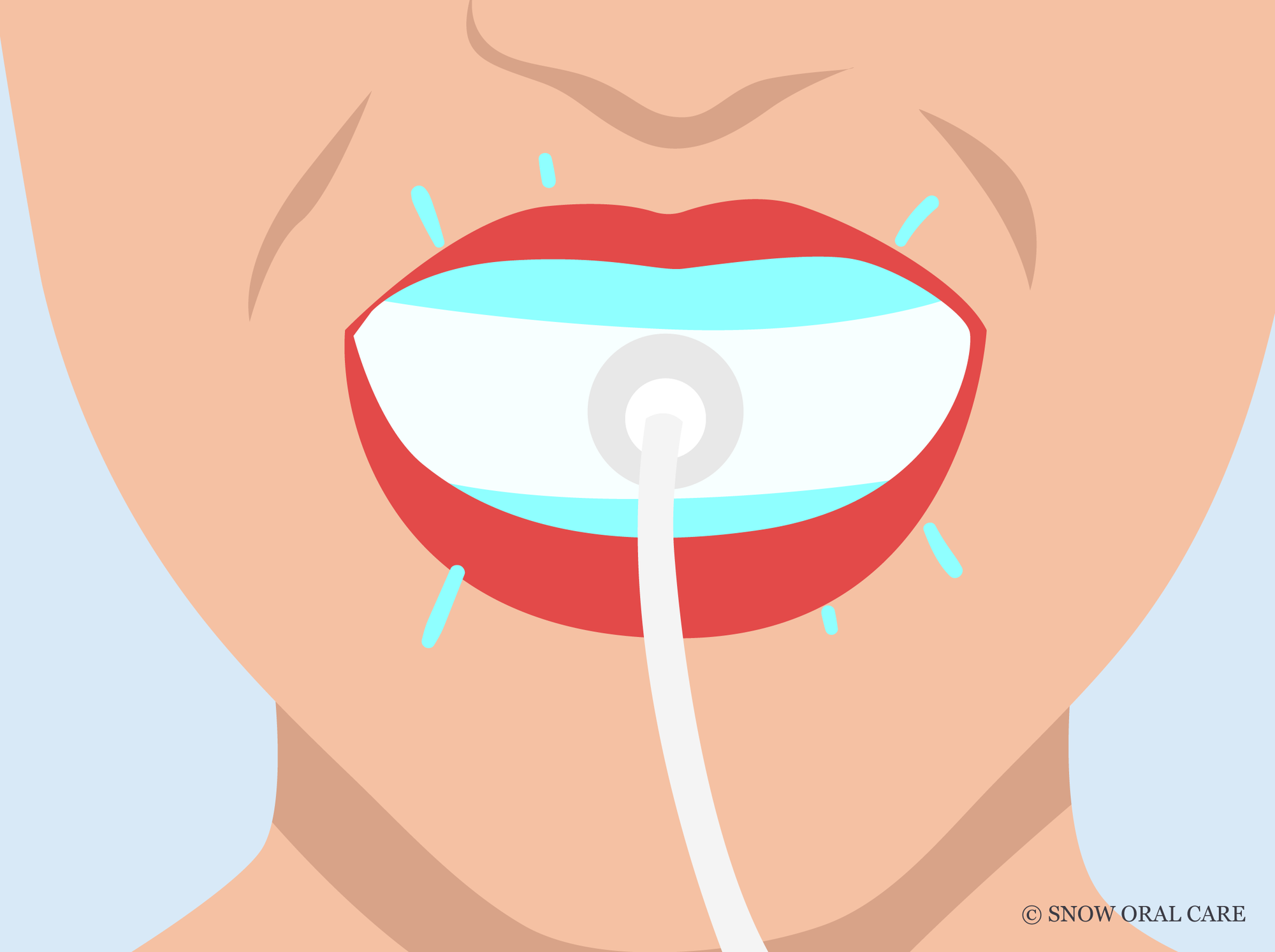 does led teeth whitening work 