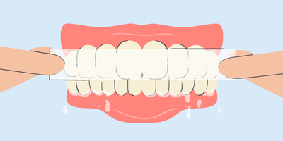 does saliva ruin teeth whitening strips