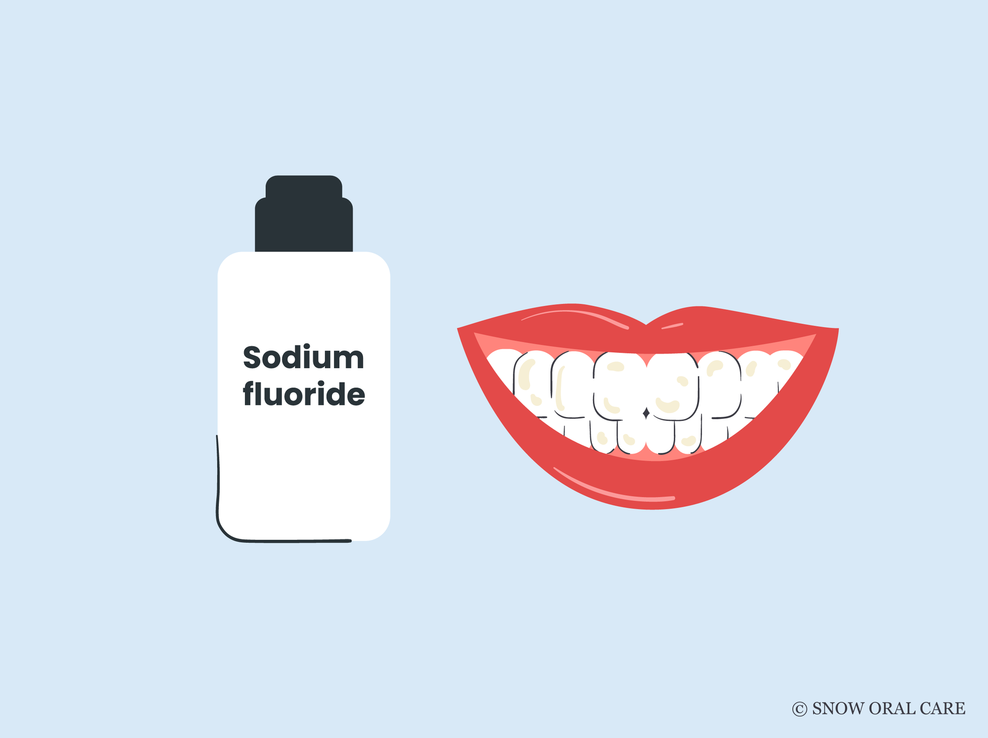 does sodium fluoride stain teeth 