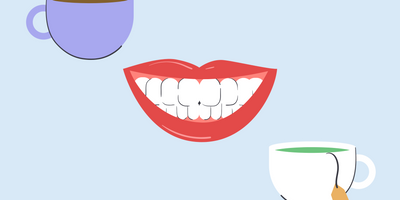 does tea stain your teeth more than coffee 