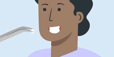 does teeth whitening damage veneers 