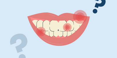 does teeth whitening hurt 