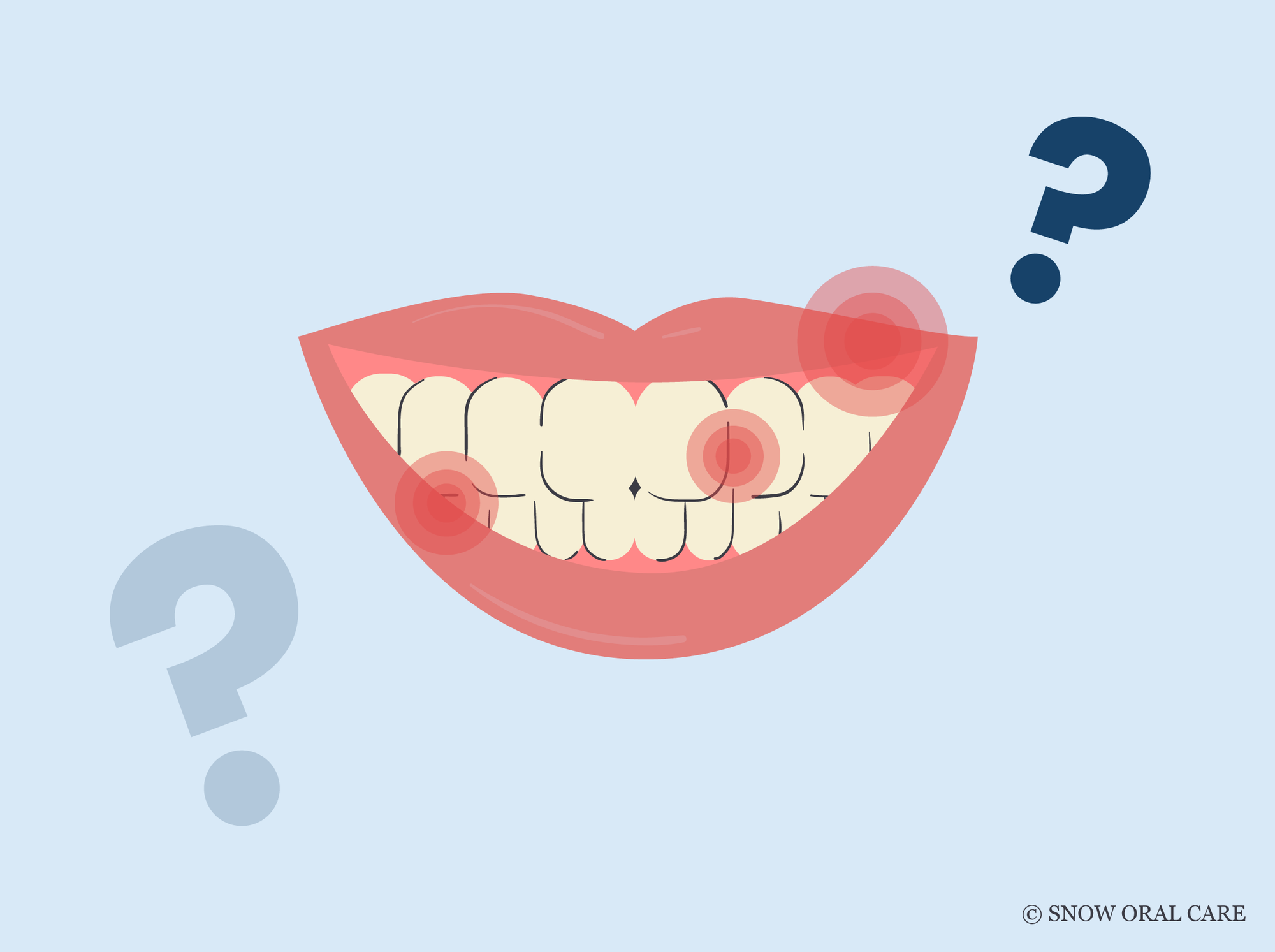 does teeth whitening hurt 