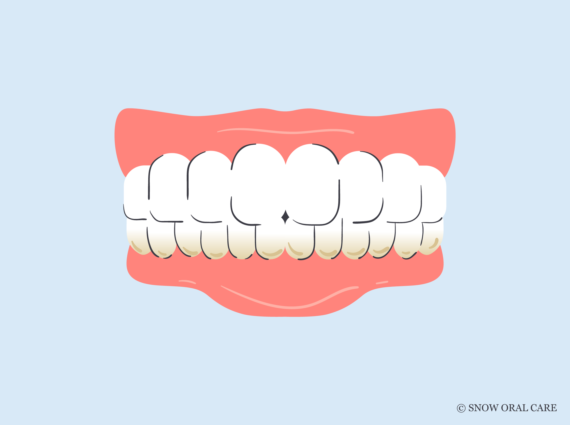 does teeth whitening remove plaque 