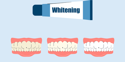 does whitening toothpaste work