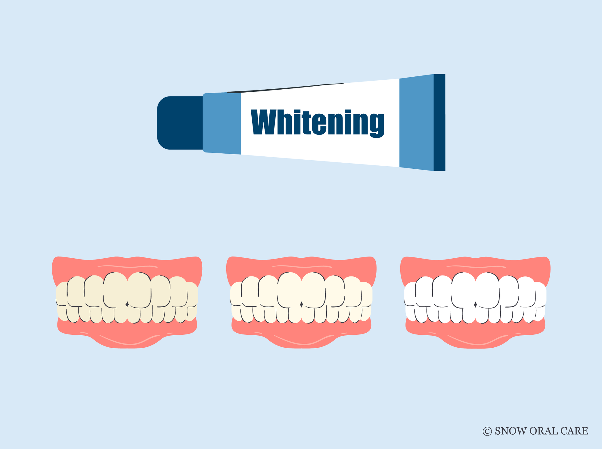 does whitening toothpaste work