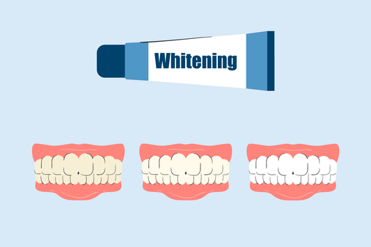 does whitening toothpaste work