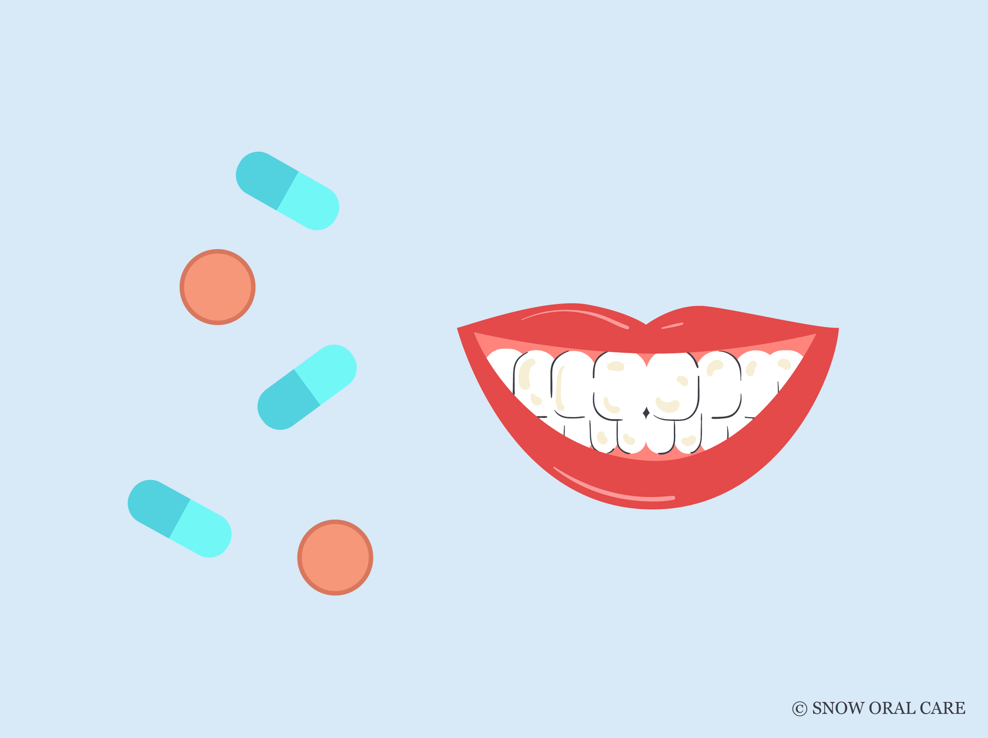 doxycycline yellow teeth 