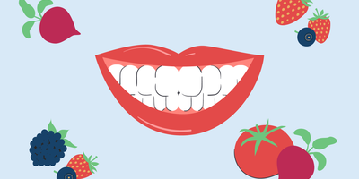 foods that stain teeth