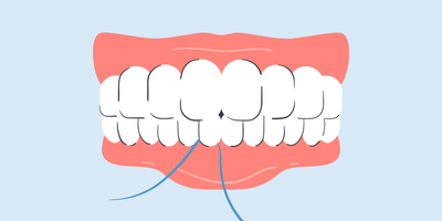 how deep should you floss