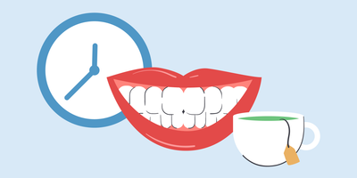 how long after home teeth whitening can i drink tea 