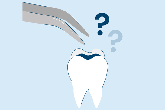 How Long Do Fillings Last?