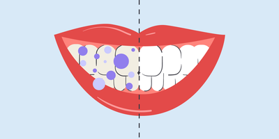how long does it take for purple toothpaste to work