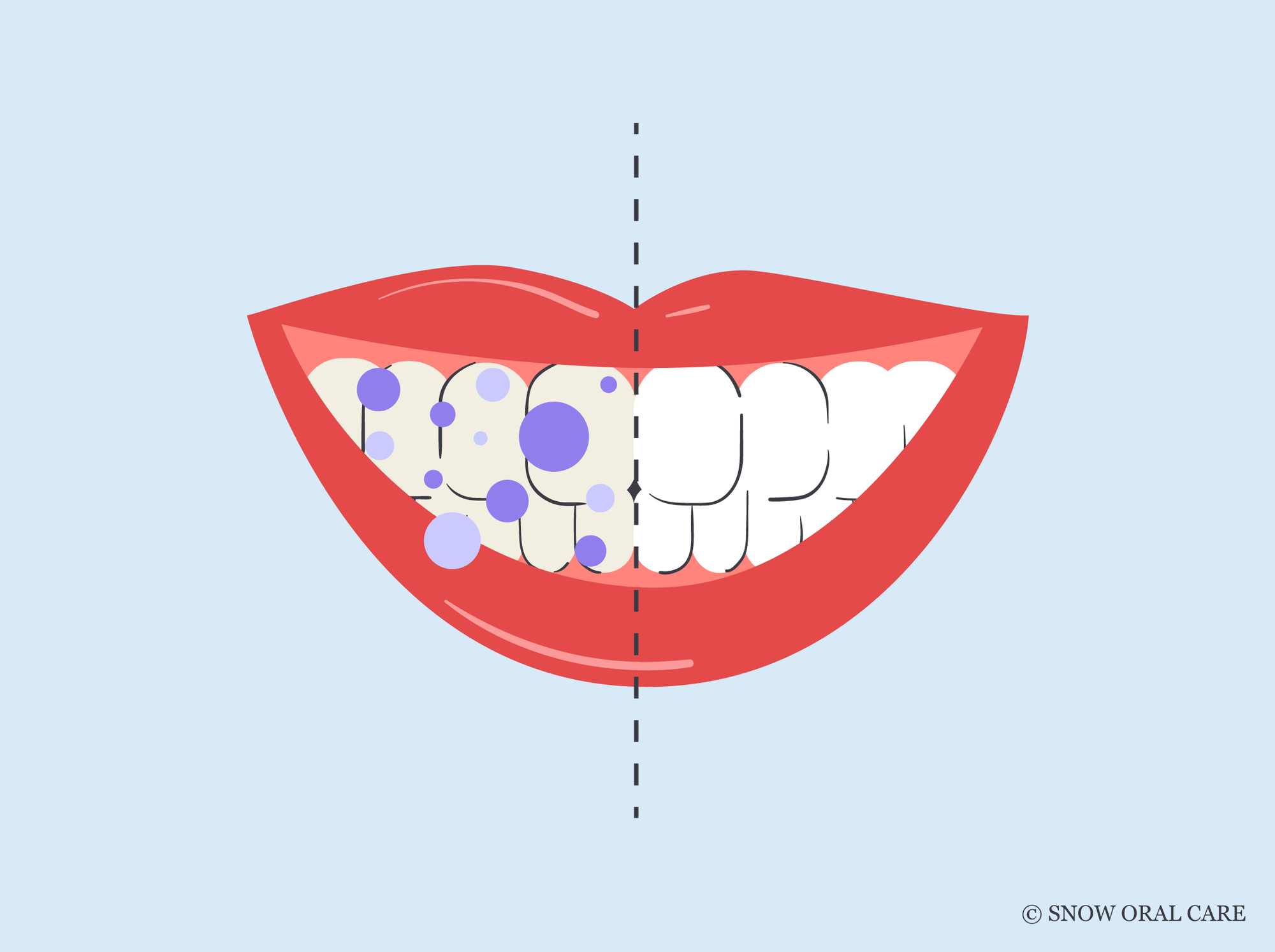 how long does it take for purple toothpaste to work