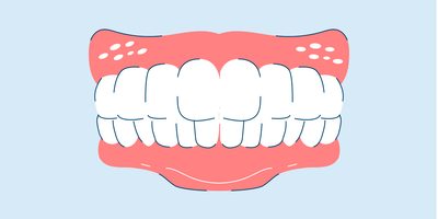 how long does it take to whiten teeth 