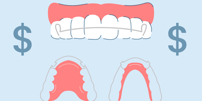 How Much Do Retainers Cost? Types, Benefits, and Care