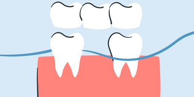 how to floss a bridge