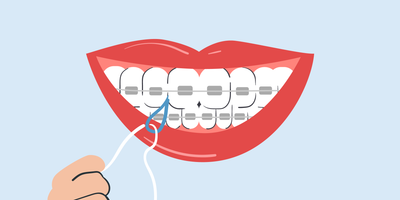 how to floss with braces