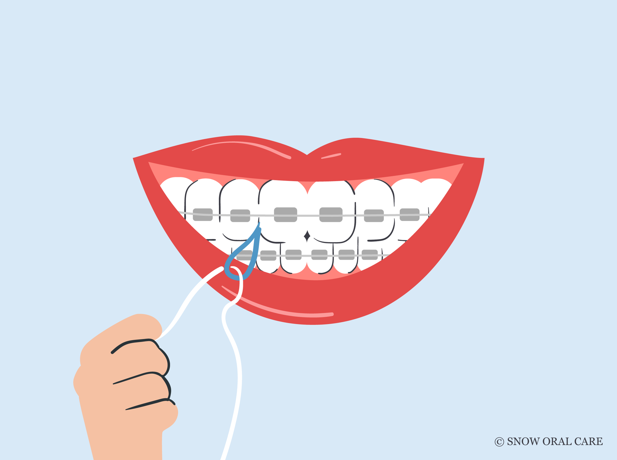 how to floss with braces