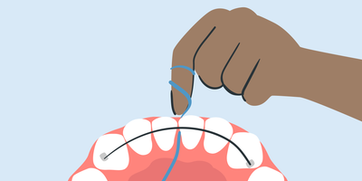 how to floss with permanent retainer