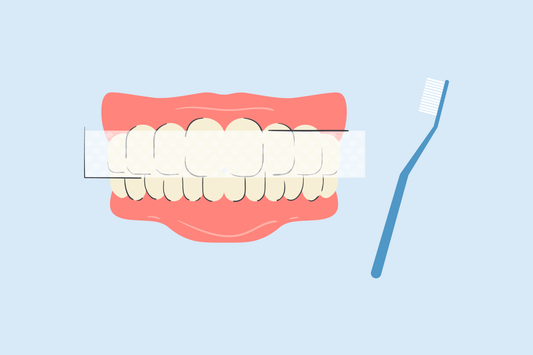 how to get rid of yellow teeth after braces 