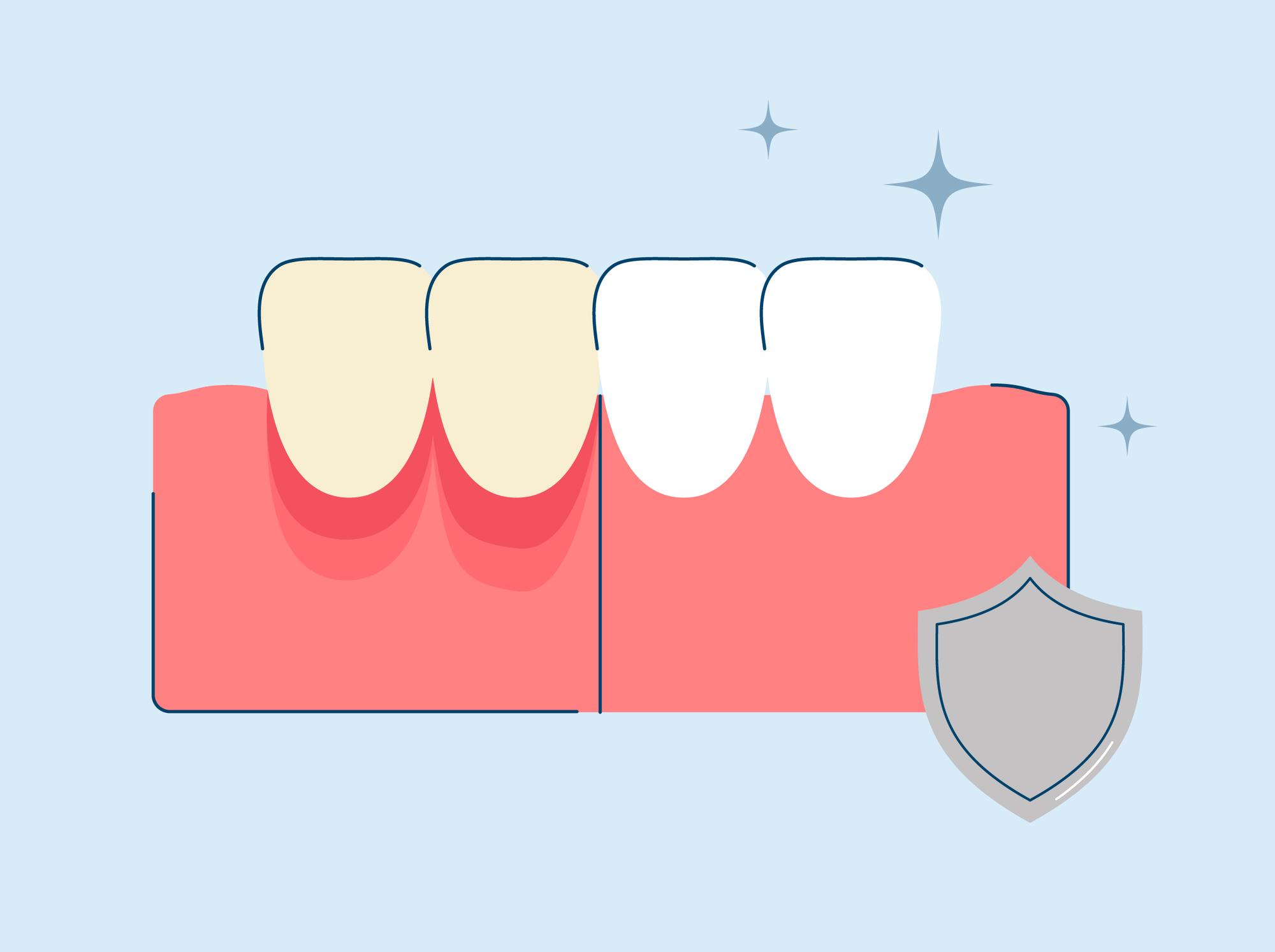 How to Protect Gums During Teeth Whitening