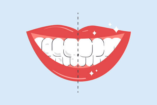 how to remove white spots on teeth at home