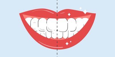 how to whiten teeth instantly 