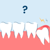 Pericoronitis: Symptoms and Treatment