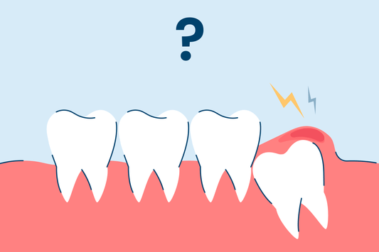 Pericoronitis: Symptoms and Treatment