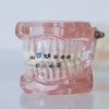 Invisalign Review