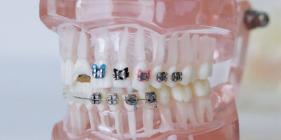 Invisalign Review