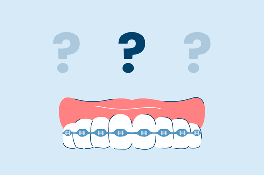 power chain braces