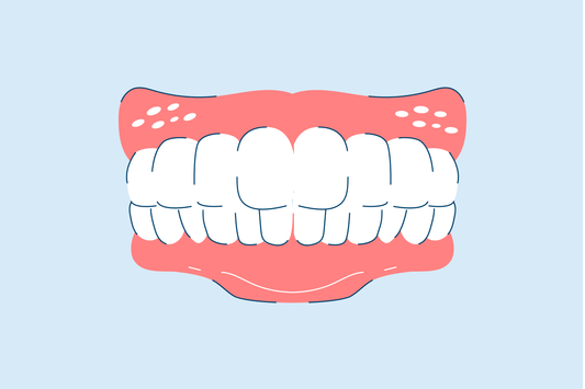 professional teeth whitening 