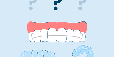 guide to retainers after braces