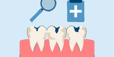 rotten teeth symptoms and treatment
