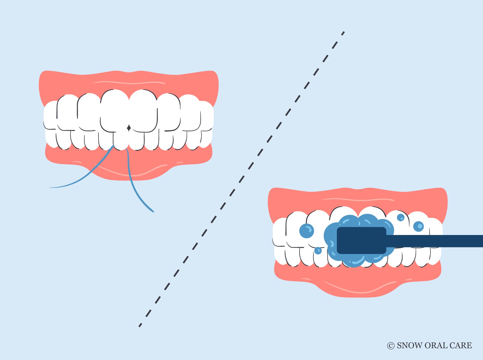 should you brush or floss first ada