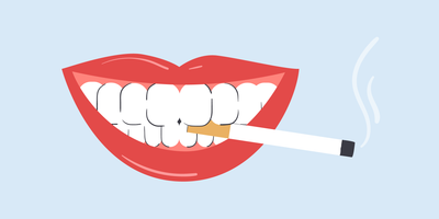 smoking after teeth whitening 